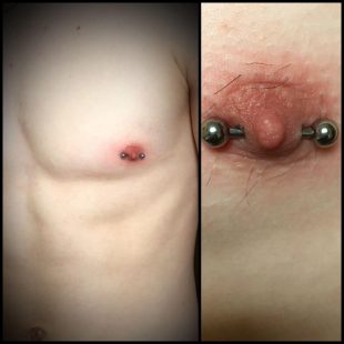 Sam nipple